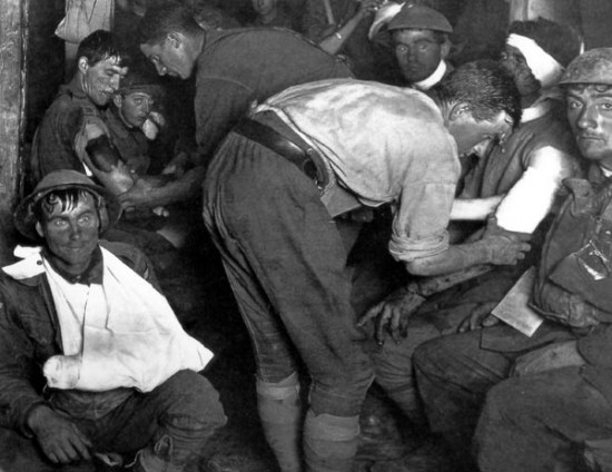 Image from World War I taken in an Australian dressing station near Ypres in 1917. The wounded soldier in the lower left of the photo has a dazed thousand-yard stare, a frequent symptom of "shell-shock". (Quelle: wikipedia)
