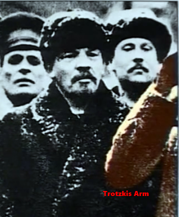 trotzkis arm1