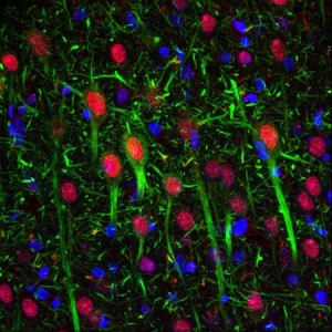 Andreas_Louis_Seyerlein_brain Andreas_Louis_Seyerlein_brain