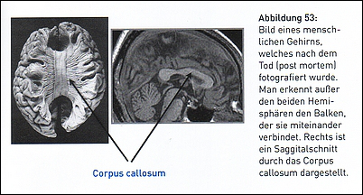 Gehirn-Hemissphären