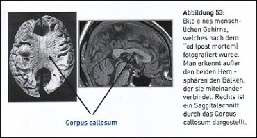 Das menschliche Gehirn - Schnitt durch die beiden Hemissphären