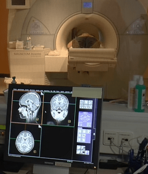 MRI Magnetresonanztomographie - Gehirn-Bildgebende Verfahren - Glarean Magazin