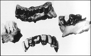 Unmittelbar nach Kriegsende exhumierten sowjetische Offiziere Hitlers verbrannte Überreste und stellten die Echtheit anhand seiner Zähne fest. Unmittelbar nach Kriegsende exhumierten sowjetische Offiziere Hitlers verbrannte Überreste und stellten die Echtheit anhand seiner Zähne fest.