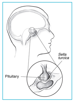 Sella Turcica