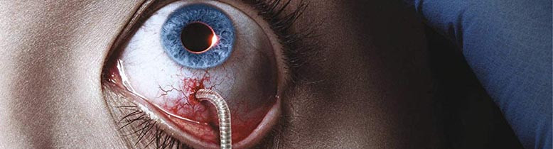 The Strain
