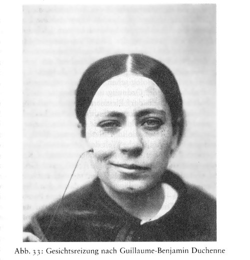 [Abbildung]